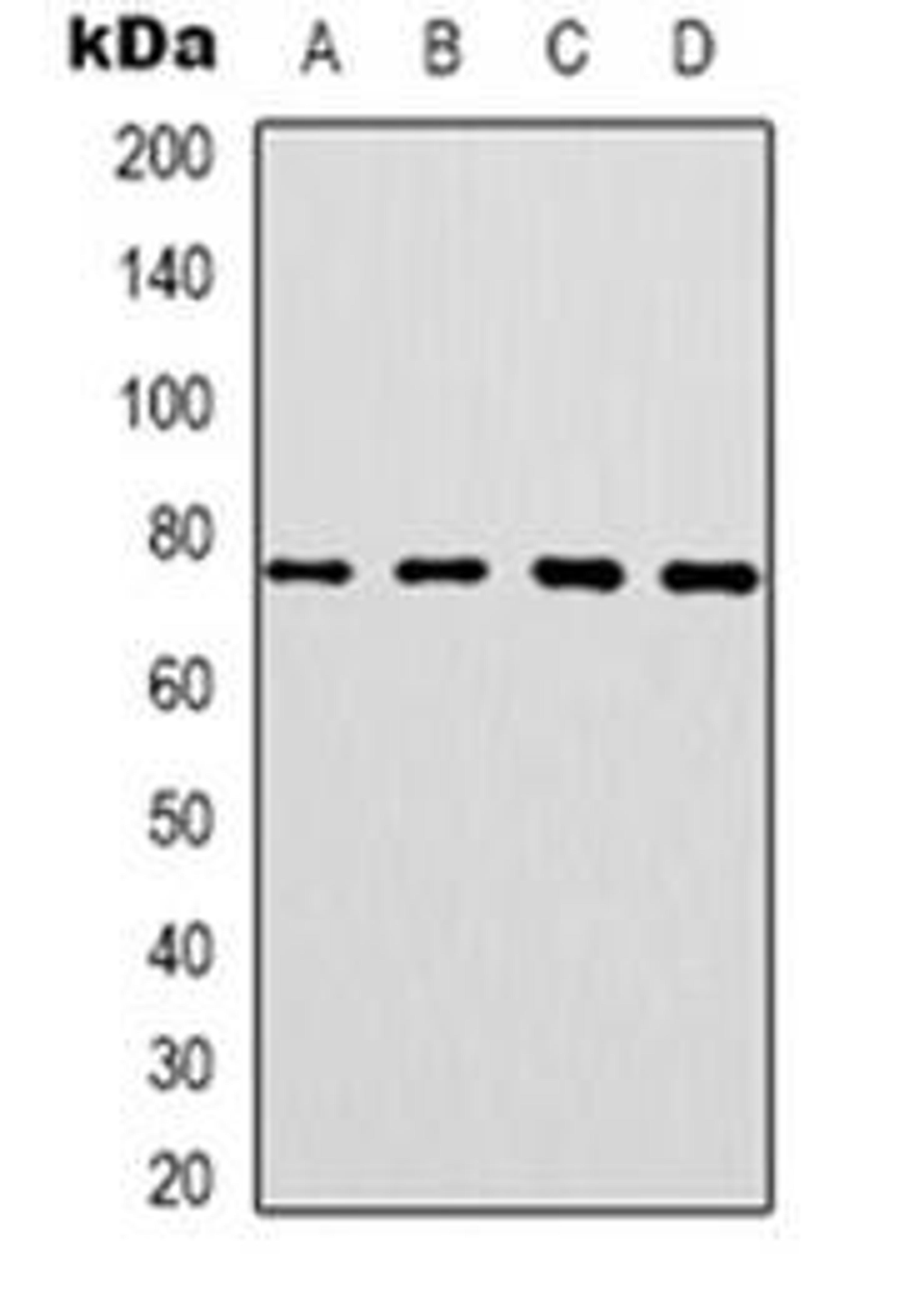 Western blot analysis of CEP76 expression in SKOV3 (Lane 1), HT29 (Lane 2), HepG2 (Lane 3), NIH3T3 (Lane 4) whole cell lysates using CEP76 antibody