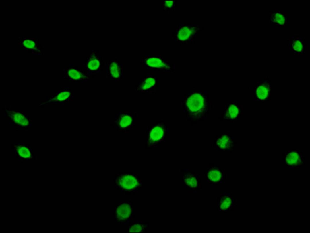 Immunofluorescence staining of Hela cells (treated with 50mM sodium 3-hydroxybutyrate for 72h) with CSB-PA010418OA56bhbHU at 1:15, counter-stained with DAPI. The cells were fixed in 4% formaldehyde, permeabilized using 0.2% Triton X-100 and blocked in 10% normal Goat Serum. The cells were then incubated with the antibody overnight at 4°C. The secondary antibody was Alexa Fluor 488-congugated AffiniPure Goat Anti-Rabbit IgG(H+L).