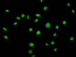 Immunofluorescence staining of Hela cells (treated with 50mM sodium 3-hydroxybutyrate for 72h) with CSB-PA010418OA56bhbHU at 1:15, counter-stained with DAPI. The cells were fixed in 4% formaldehyde, permeabilized using 0.2% Triton X-100 and blocked in 10% normal Goat Serum. The cells were then incubated with the antibody overnight at 4°C. The secondary antibody was Alexa Fluor 488-congugated AffiniPure Goat Anti-Rabbit IgG(H+L).