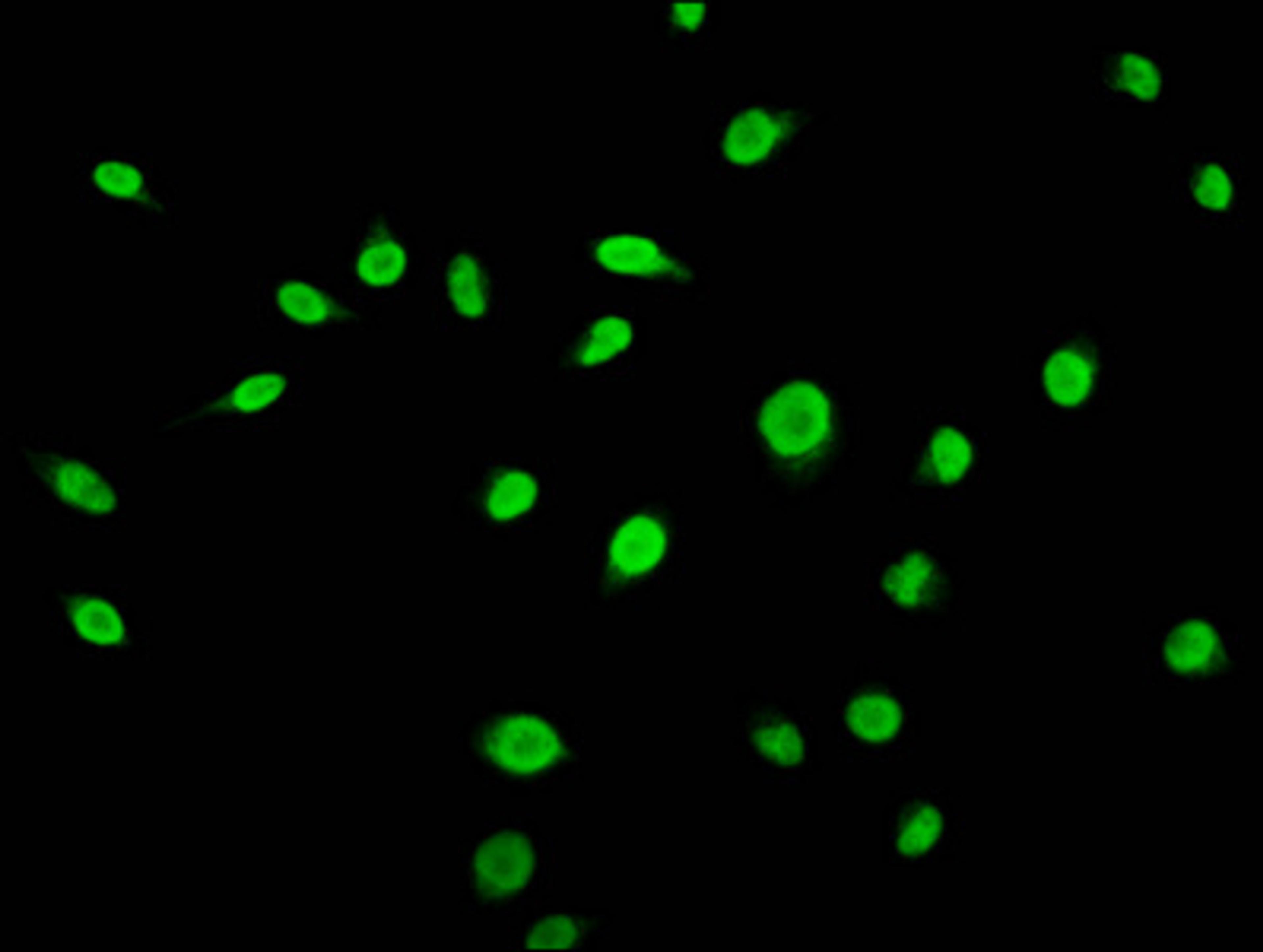 Immunofluorescence staining of Hela cells (treated with 50mM sodium 3-hydroxybutyrate for 72h) with CSB-PA010418OA56bhbHU at 1:15, counter-stained with DAPI. The cells were fixed in 4% formaldehyde, permeabilized using 0.2% Triton X-100 and blocked in 10% normal Goat Serum. The cells were then incubated with the antibody overnight at 4°C. The secondary antibody was Alexa Fluor 488-congugated AffiniPure Goat Anti-Rabbit IgG(H+L).