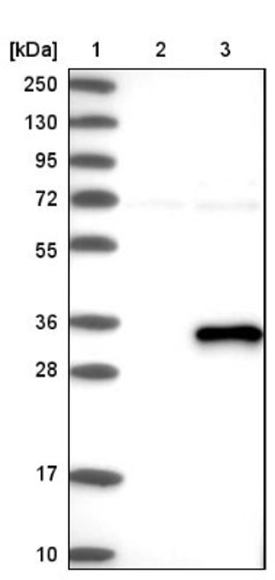 Western Blot: ABHD12B Antibody [NBP1-88669] - Lane 1: Marker [kDa] 250, 130, 95, 72, 55, 36, 28, 17, 10<br/>Lane 2: Negative control (vector only transfected HEK293T lysate)<br/>Lane 3: Over-expression lysate (Co-expressed with a C-terminal myc-DDK tag (~3.1 kDa) in mammalian HEK293T cells, LY405695)