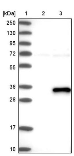 Western Blot: ABHD12B Antibody [NBP1-88669] - Lane 1: Marker [kDa] 250, 130, 95, 72, 55, 36, 28, 17, 10<br/>Lane 2: Negative control (vector only transfected HEK293T lysate)<br/>Lane 3: Over-expression lysate (Co-expressed with a C-terminal myc-DDK tag (~3.1 kDa) in mammalian HEK293T cells, LY405695)