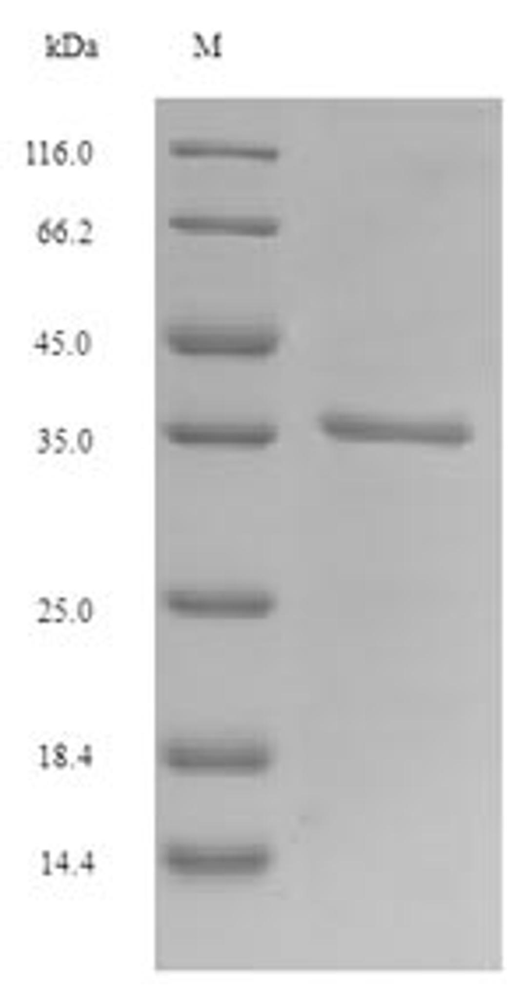 (Tris-Glycine gel) Discontinuous SDS-PAGE (reduced) with 5% enrichment gel and 15% separation gel.