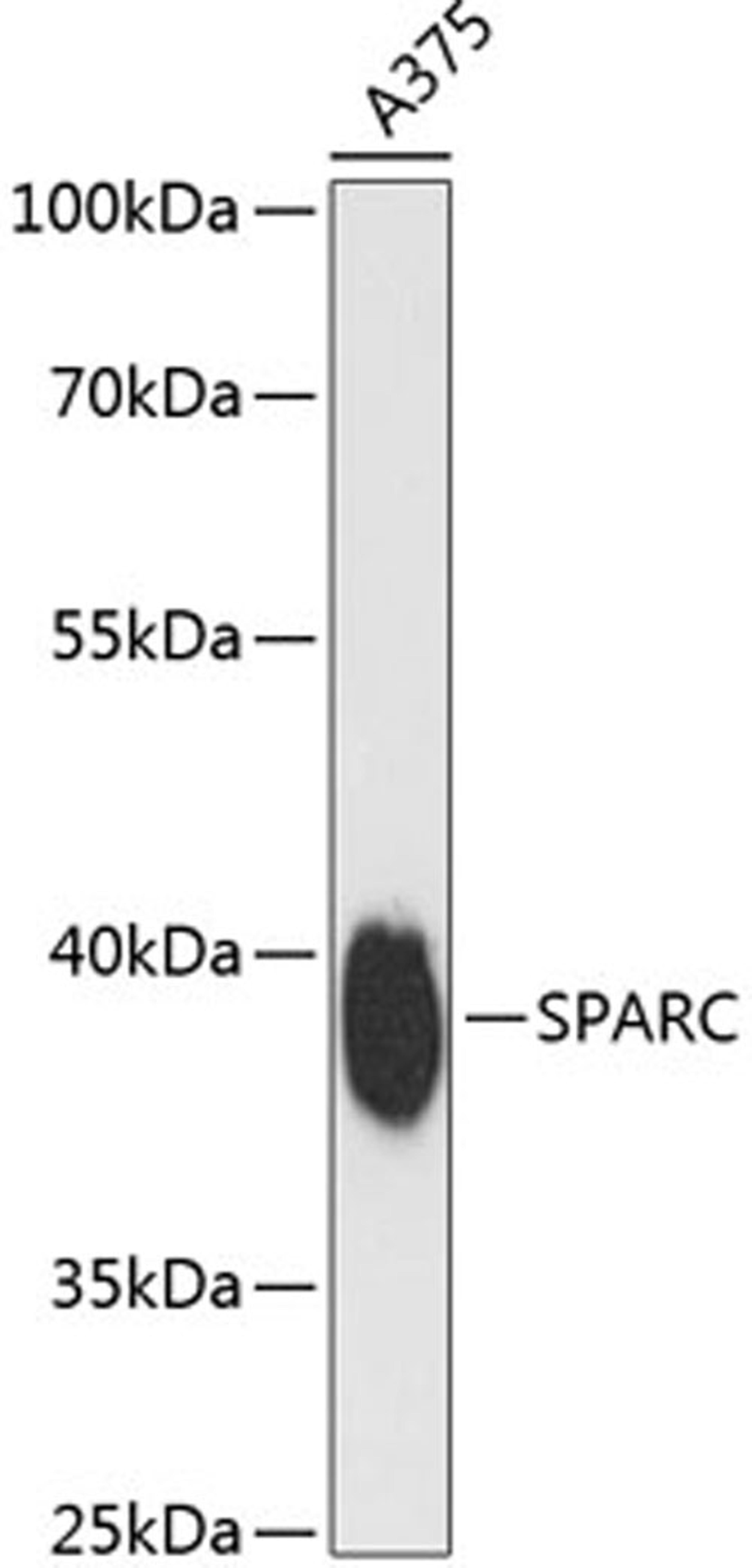 Western blot - SPARC antibody (A14494)