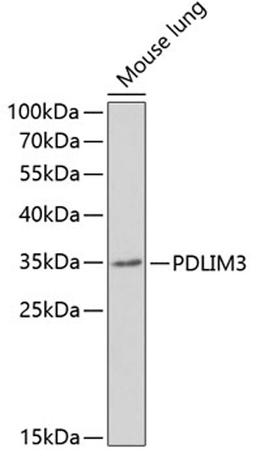 Western blot - PDLIM3 antibody (A6346)