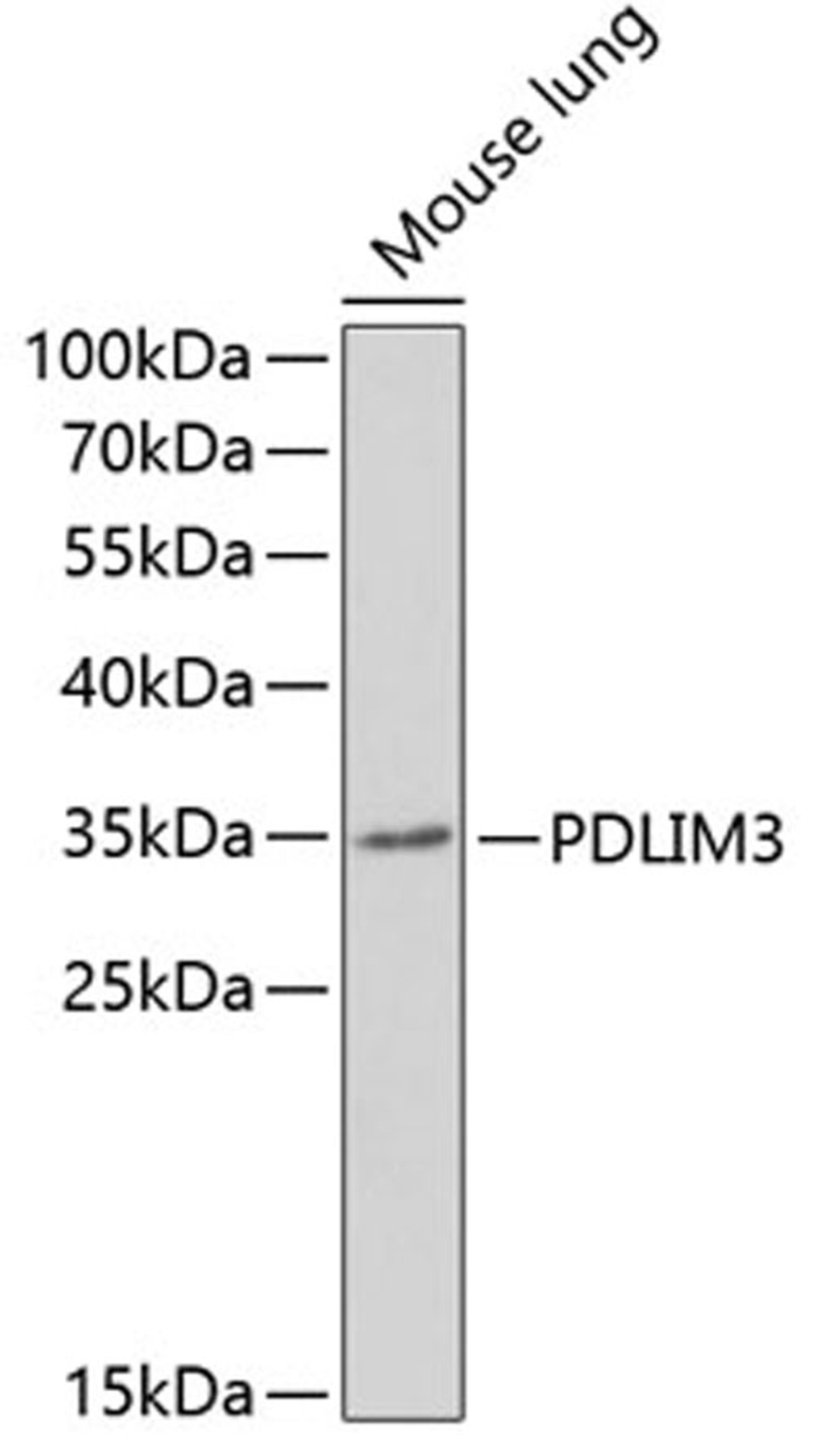 Western blot - PDLIM3 antibody (A6346)