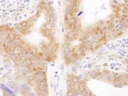 Detection of human RPL6 by immunohistochemistry.