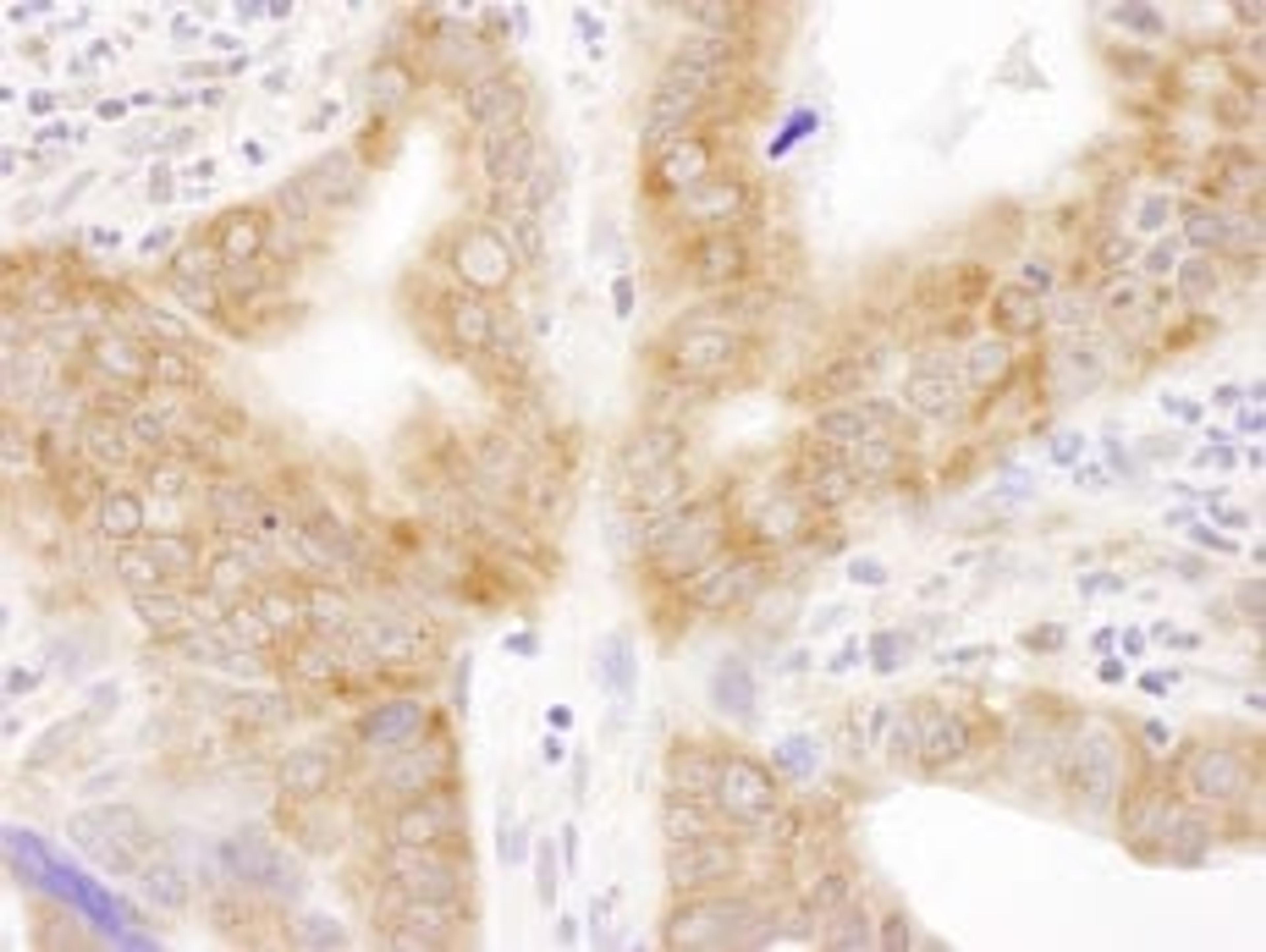 Detection of human RPL6 by immunohistochemistry.