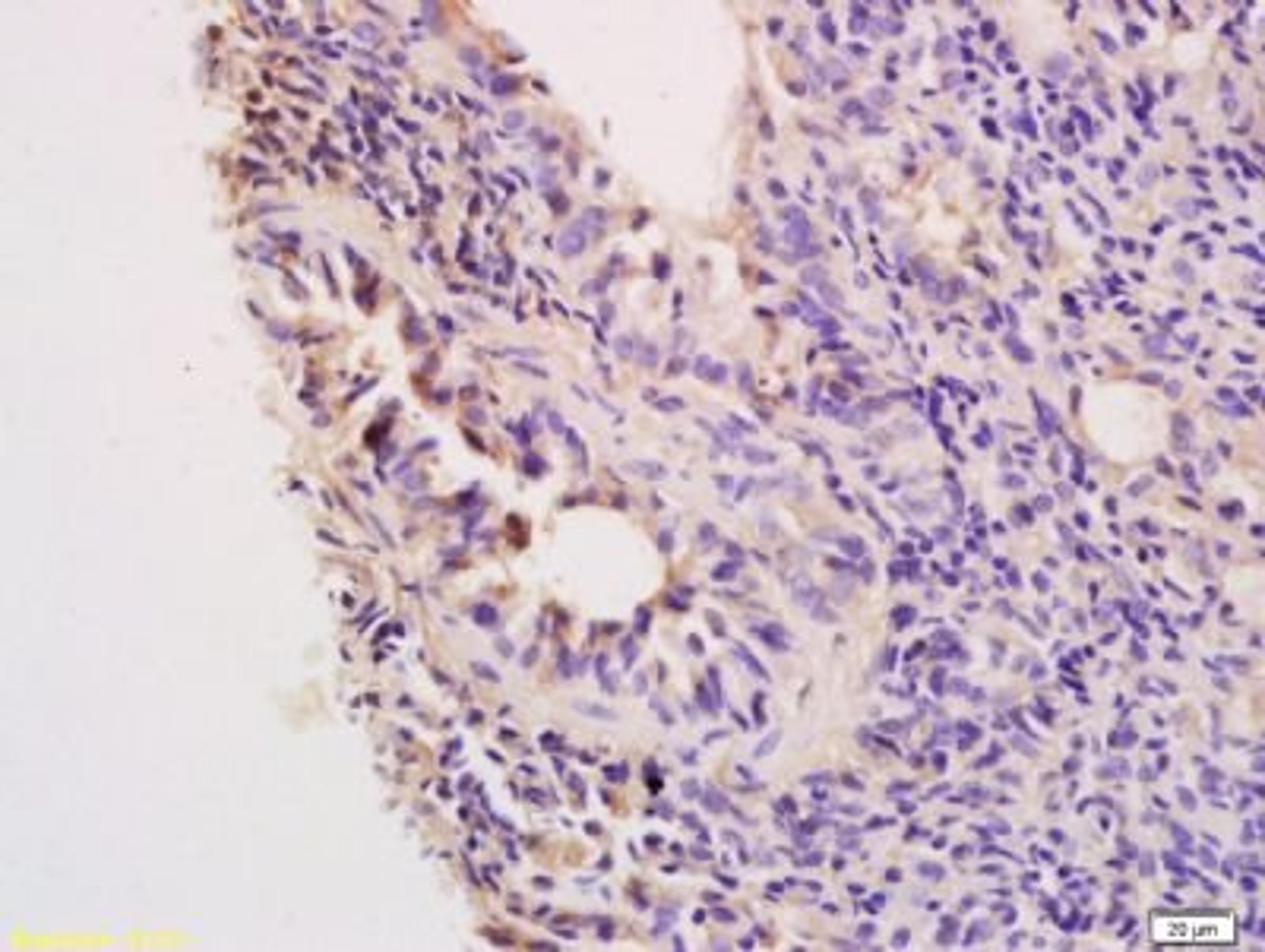 Immunohistochemical staining of Rat lung tissue using CCL13 antibody.