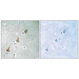 Immunohistochemistry analysis of paraffin-embedded human brain tissue using PECAM-1 (Ab-713) antibody.