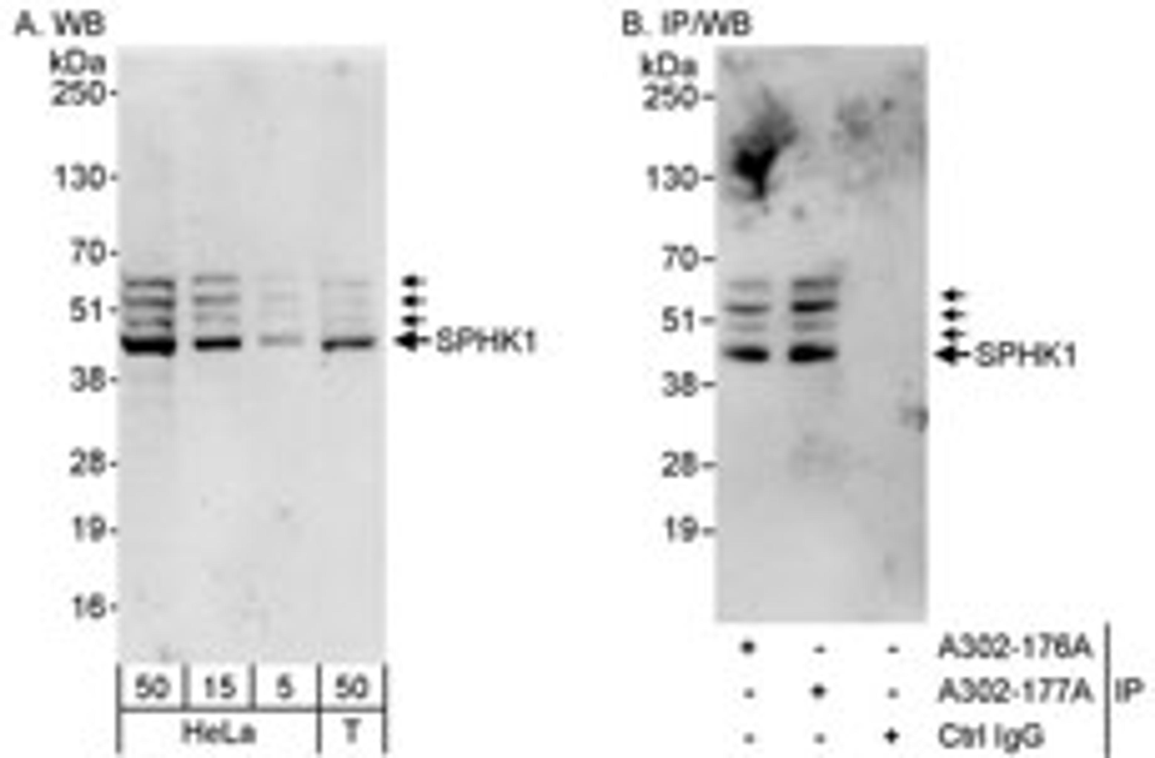 Detection of human SPHK1 by western blot and immunoprecipitation.