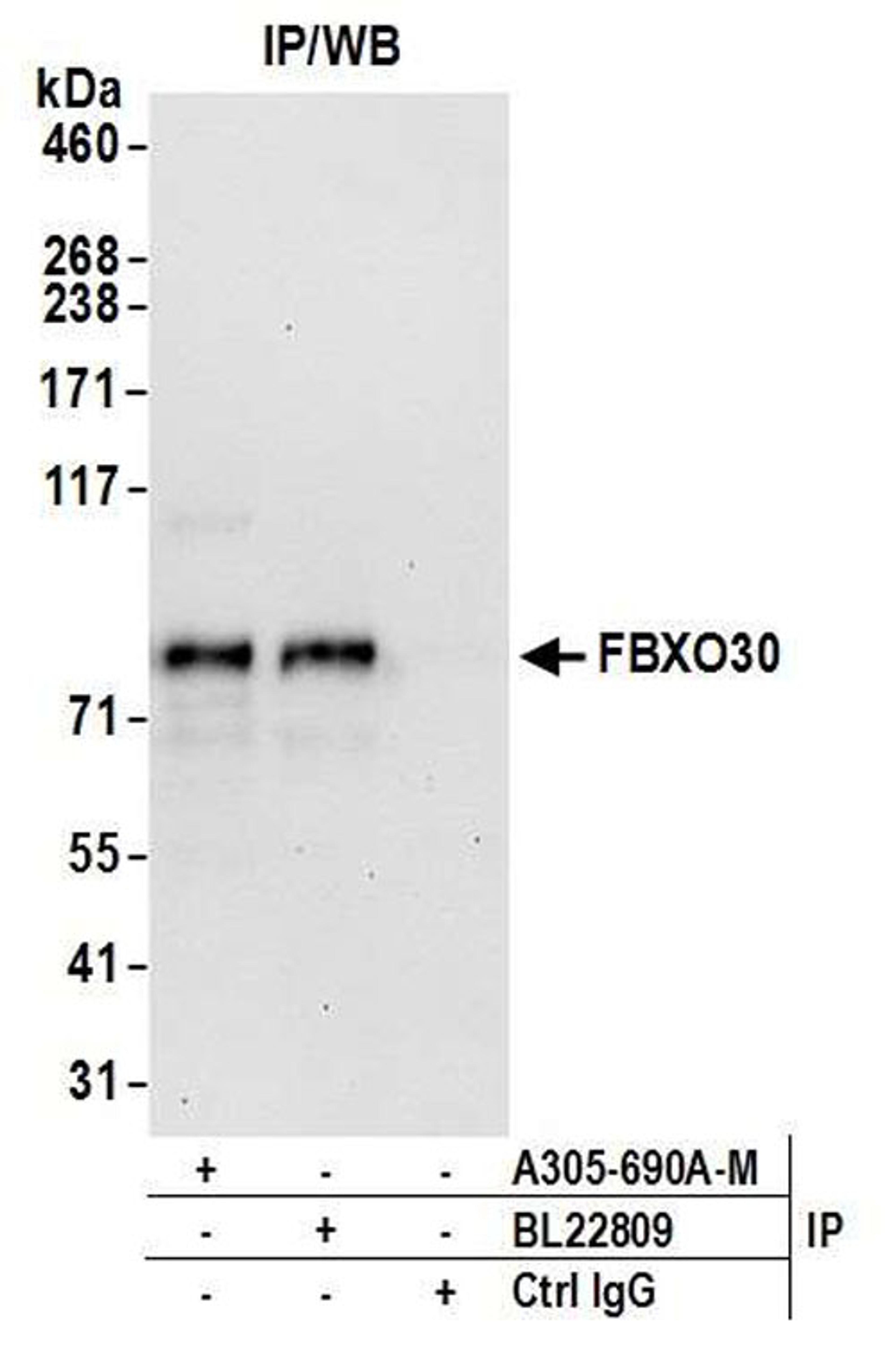 Detection of human FBXO30 by WB of IP.