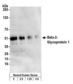 Detection of human Beta-2-Glycoprotein 1 by western blot.