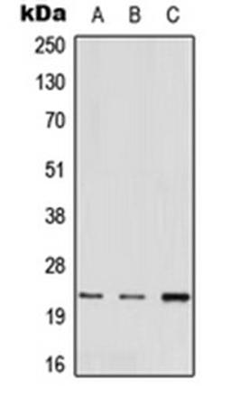 Western blot analysis of A549 (Lane 1), mouse heart (Lane 2), rat liver (Lane 3) whole cell lysates using MED22 antibody