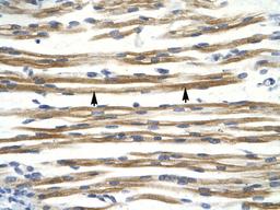 Antibody used in IHC on Human Muscle.