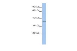 Antibody used in WB on Human HepG2 at 0.2-1 ug/ml.