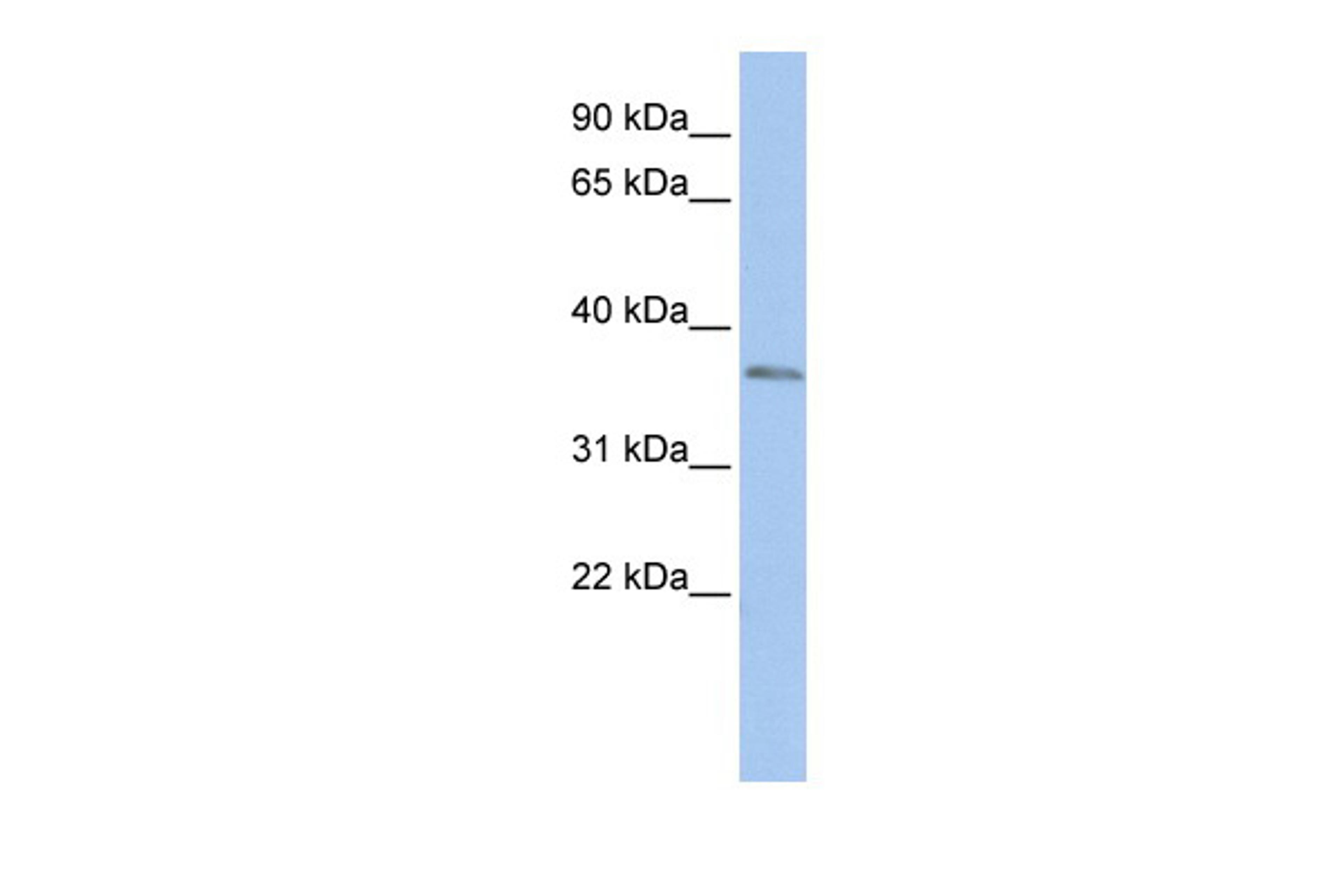 Antibody used in WB on Human HepG2 at 0.2-1 ug/ml.