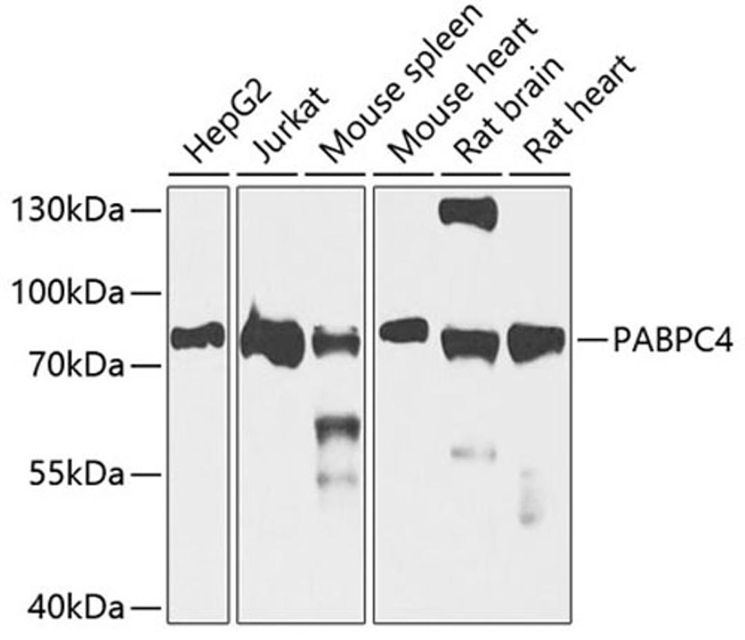 Western blot - PABPC4 antibody (A5948)