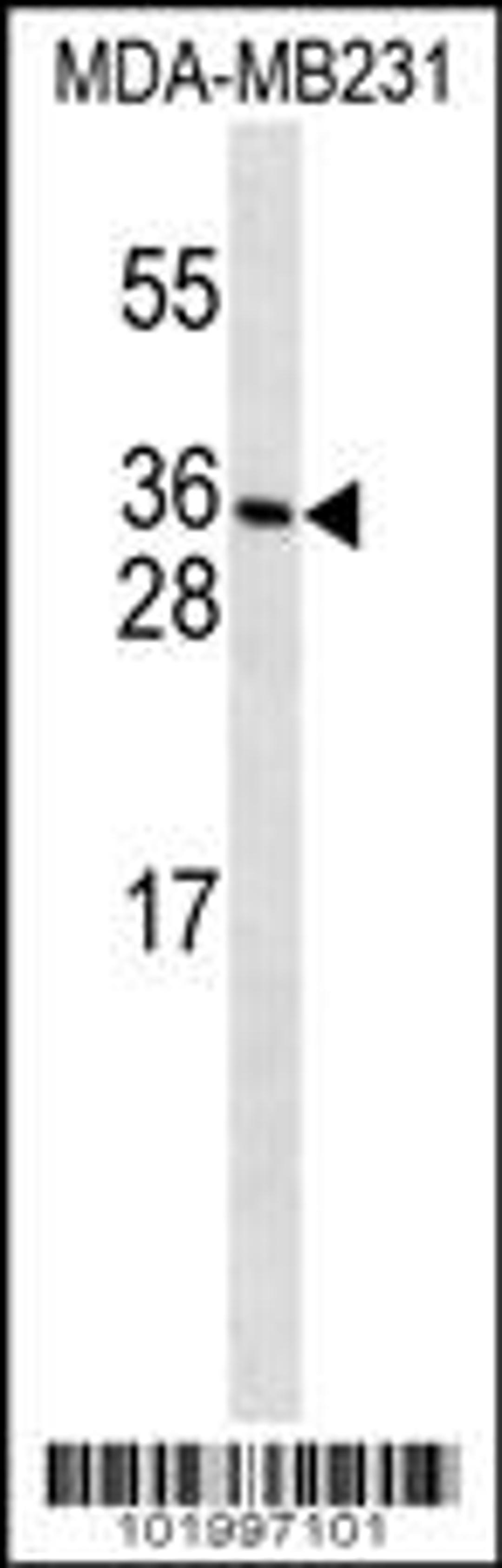 Western blot analysis in MDA-MB231 cell line lysates (35ug/lane).