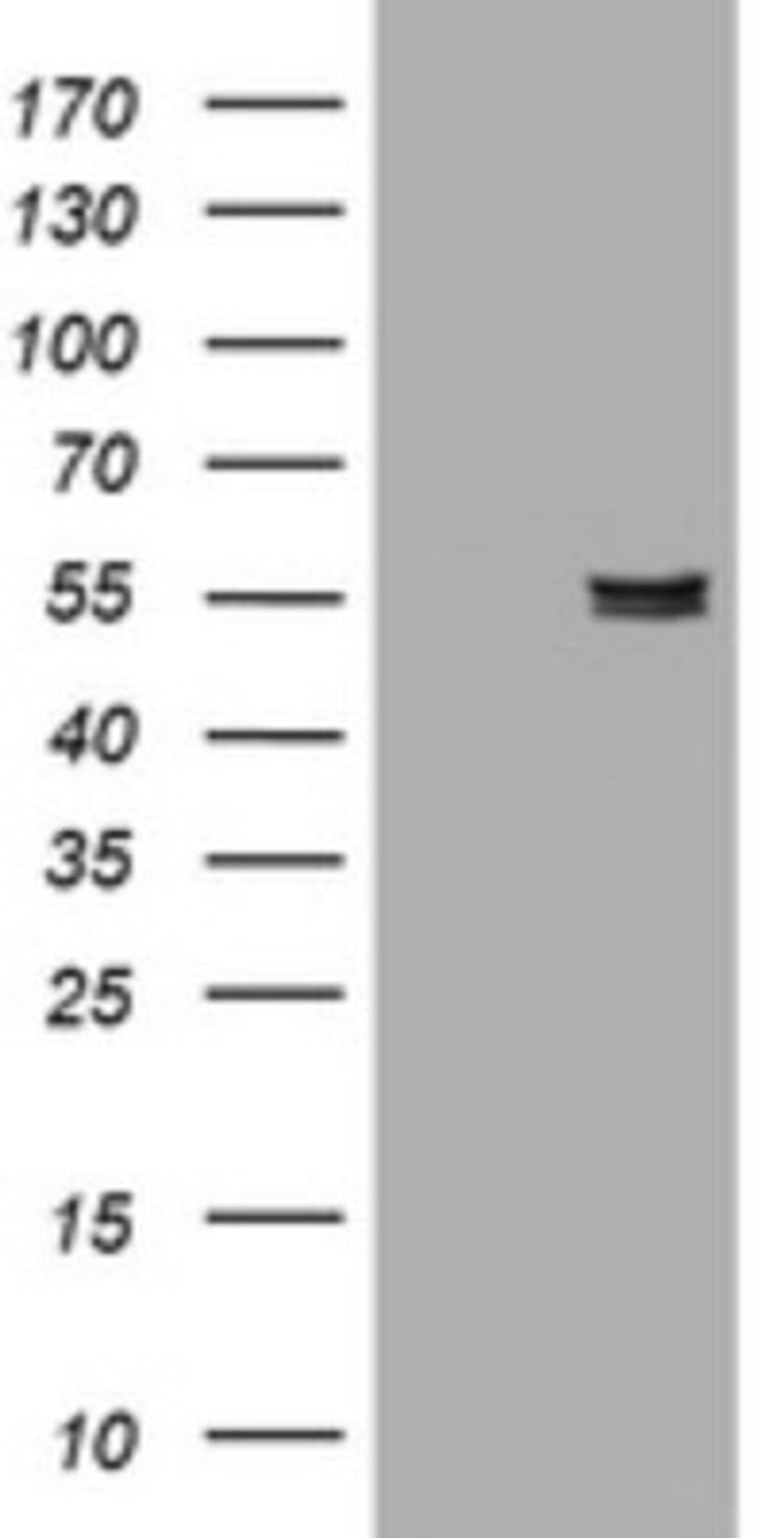 Western Blot: Pancreatic Amylase Beta Antibody (4B5) [NBP2-45492] - Analysis of HEK293T cells were transfected with the pCMV6-ENTRY control (Left lane) or pCMV6-ENTRY Amylase beta.