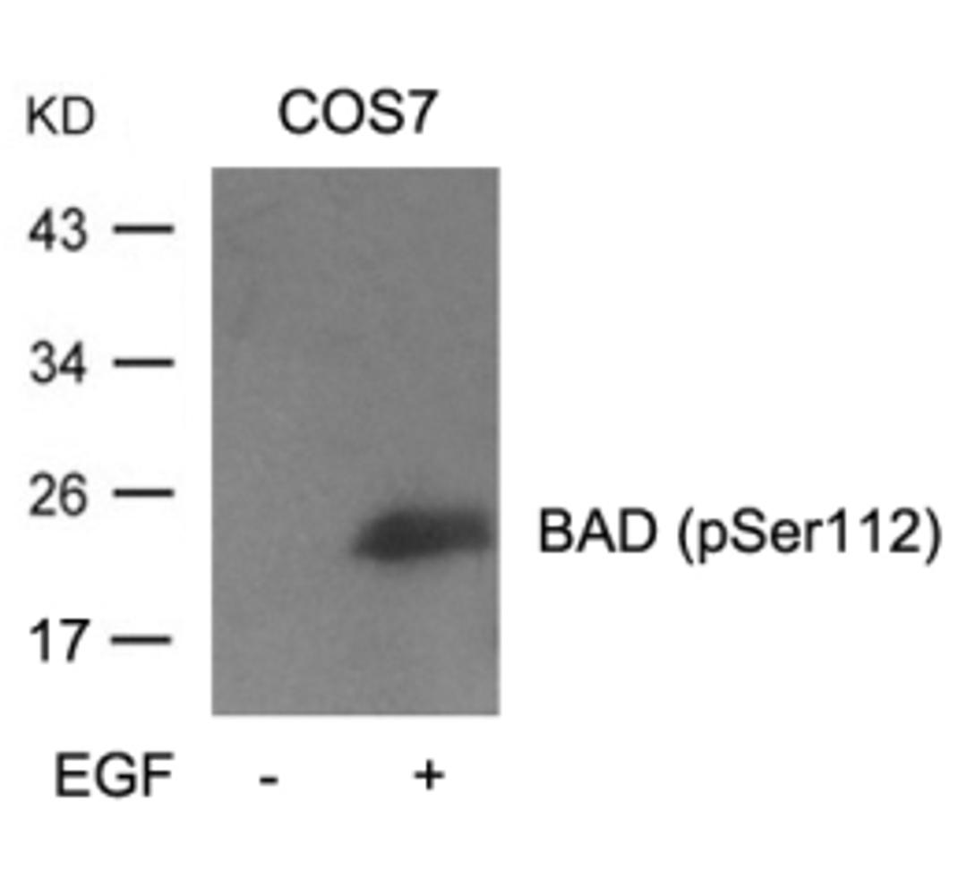 Western blot analysis of lysed extracts from cos7 cells untreated or treated with EGF using BAD (Phospho-Ser112).