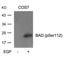 Western blot analysis of lysed extracts from cos7 cells untreated or treated with EGF using BAD (Phospho-Ser112).