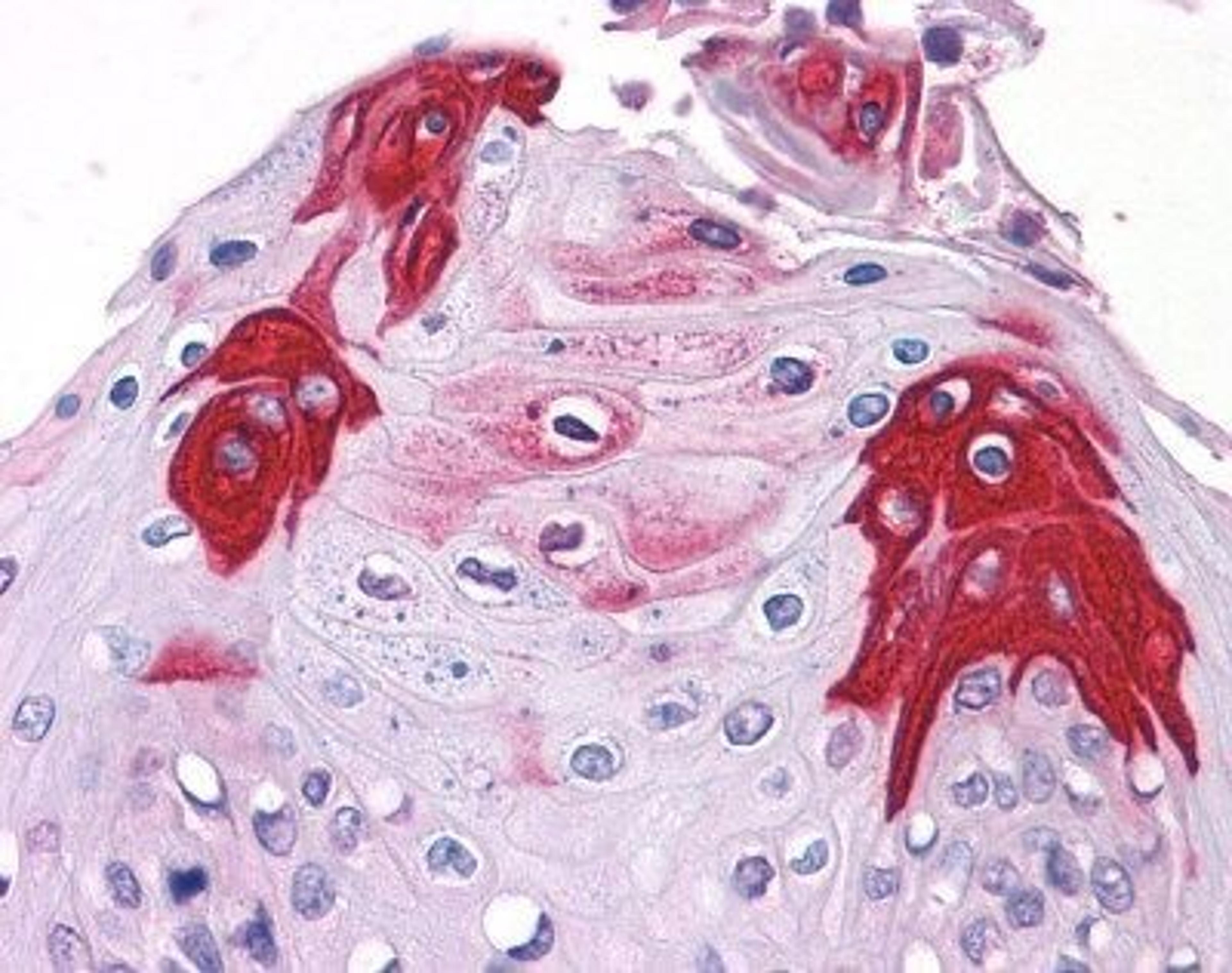 Immunohistochemistry-Paraffin: TAS1R3 Antibody [NLS5060] - Analysis of anti-T1R3 / TAS1R3 antibody with tongue, squamous epithelium at 17 ug/ ml.