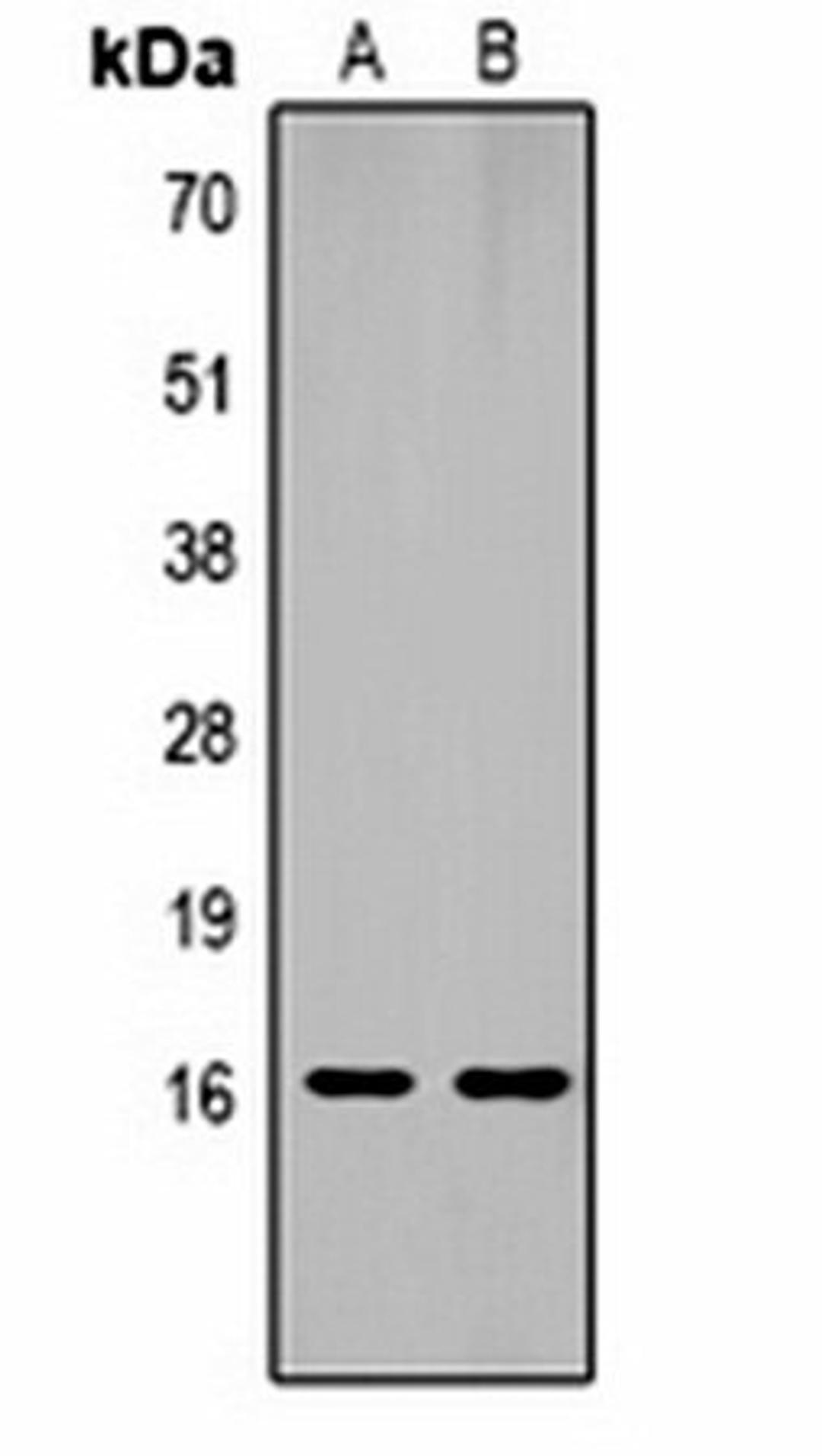 Western blot analysis of  Hela (Lane1), NIH3T3 (Lane2) whole cell lysates using Histone H1 (MonoMethyl K25) antibody