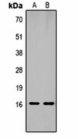 Western blot analysis of  Hela (Lane1), NIH3T3 (Lane2) whole cell lysates using Histone H1 (MonoMethyl K25) antibody