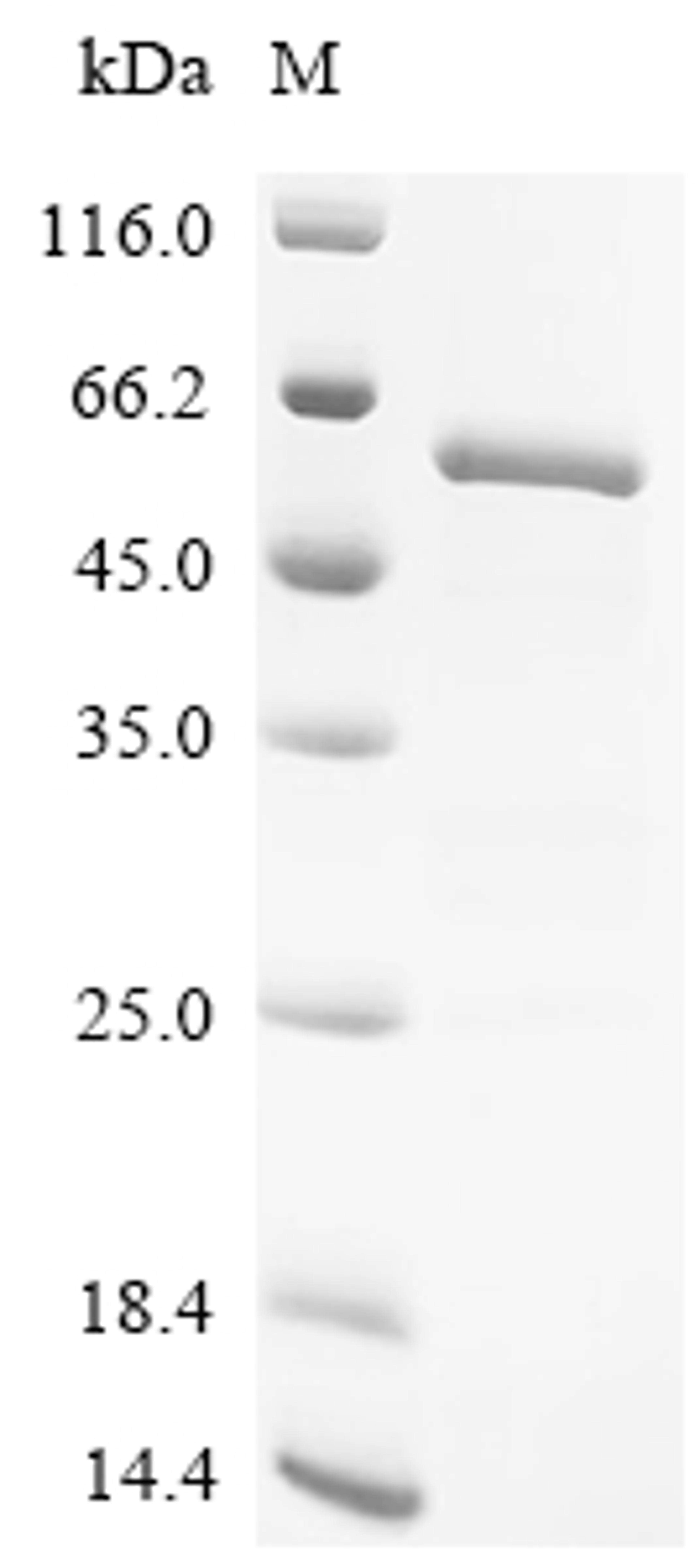 (Tris-Glycine gel) Discontinuous SDS-PAGE (reduced) with 5% enrichment gel and 15% separation gel.