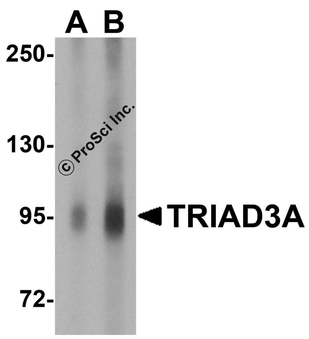 Western blot analysis of TRIAD3A in mouse heart tissue lysate with TRIAD3A antibody at (A) 1 and (B) 2 μg/mL.