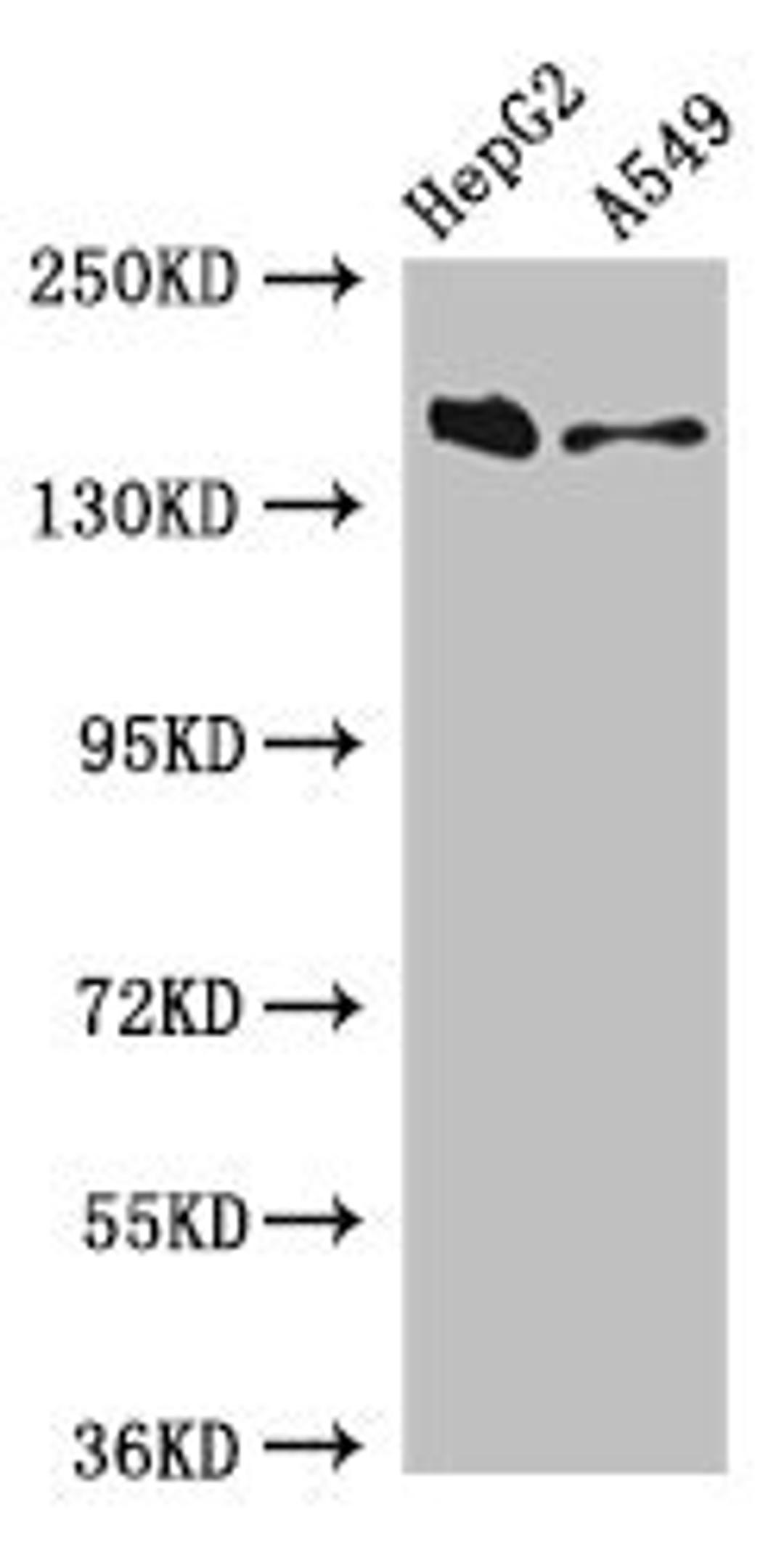 Western Blot. Positive WB detected in: HepG2 whole cell lysate, A549 whole cell lysate. All lanes: DOT1L antibody at 3ug/ml. Secondary. Goat polyclonal to rabbit IgG at 1/50000 dilution. Predicted band size: 185, 165 kDa. Observed band size: 185 kDa. 