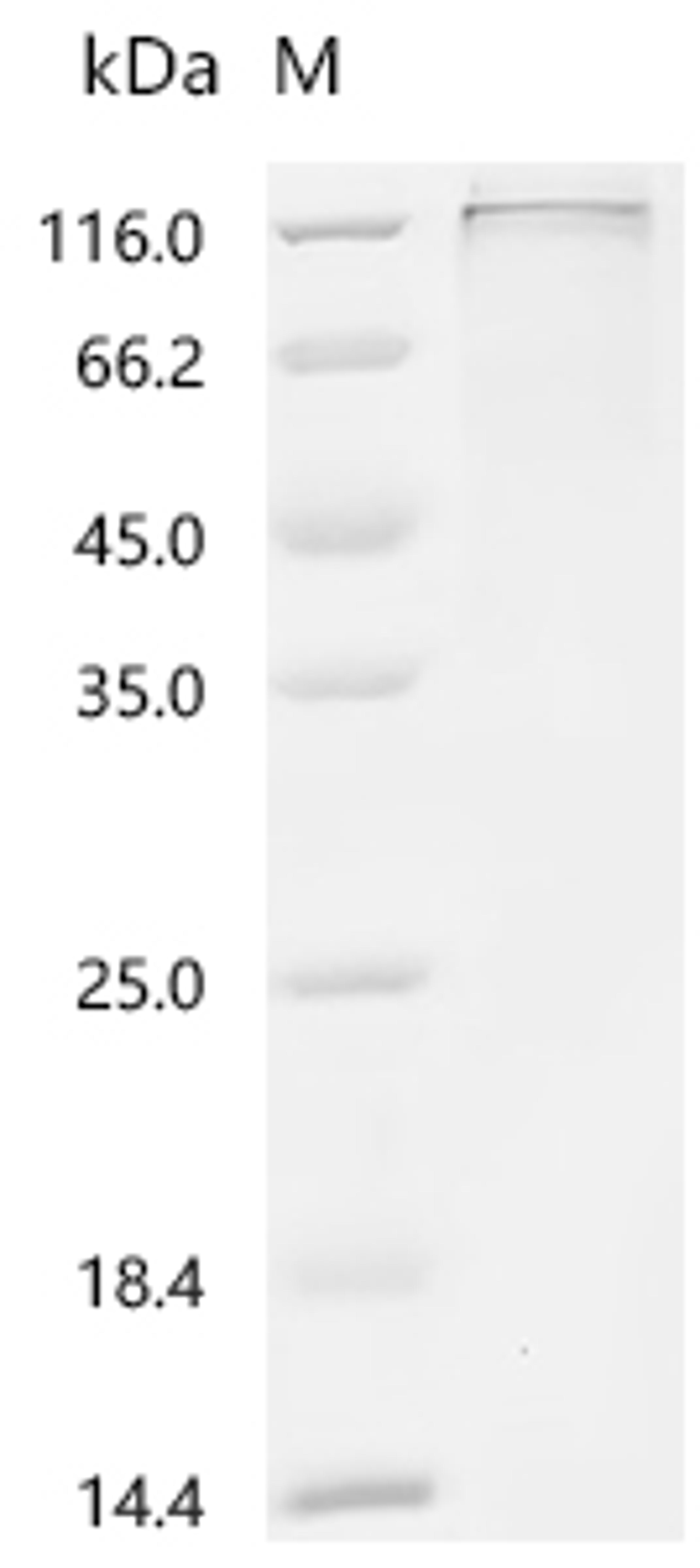 (Tris-Glycine gel) Discontinuous SDS-PAGE (reduced) with 5% enrichment gel and 15% separation gel.