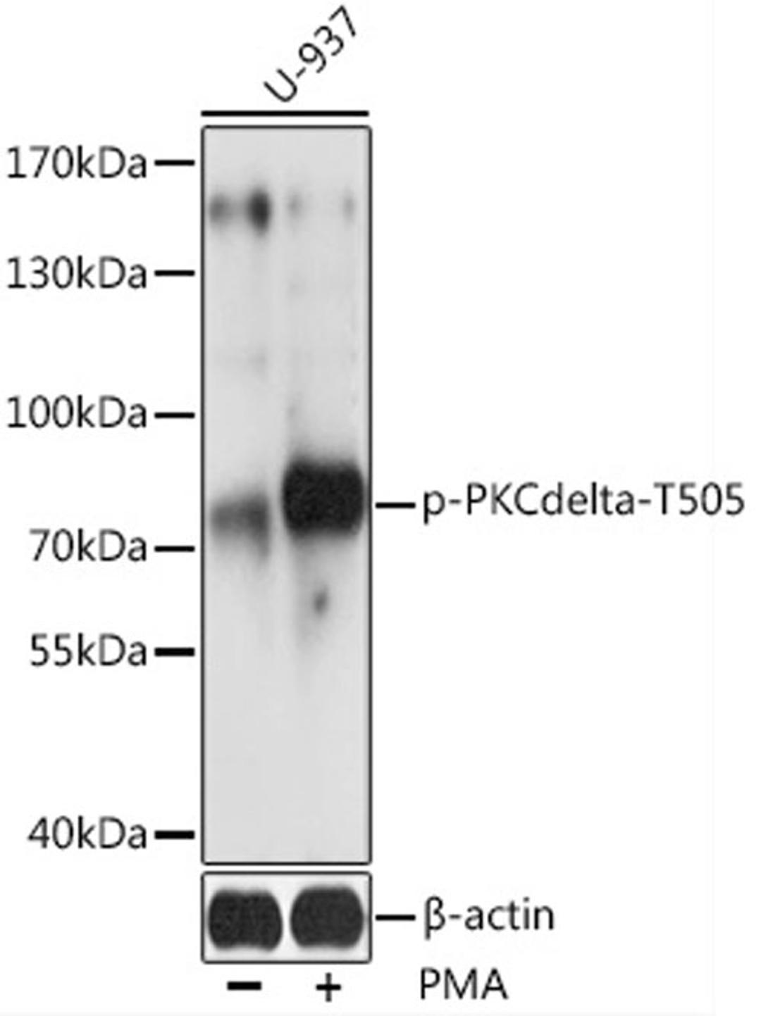 Western blot - Phospho-PKCdelta-T505 antibody (AP0776)