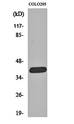 Western blot analysis of COLO205 cell lysates using ORCTL2 antibody