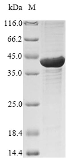 (Tris-Glycine gel) Discontinuous SDS-PAGE (reduced) with 5% enrichment gel and 15% separation gel.