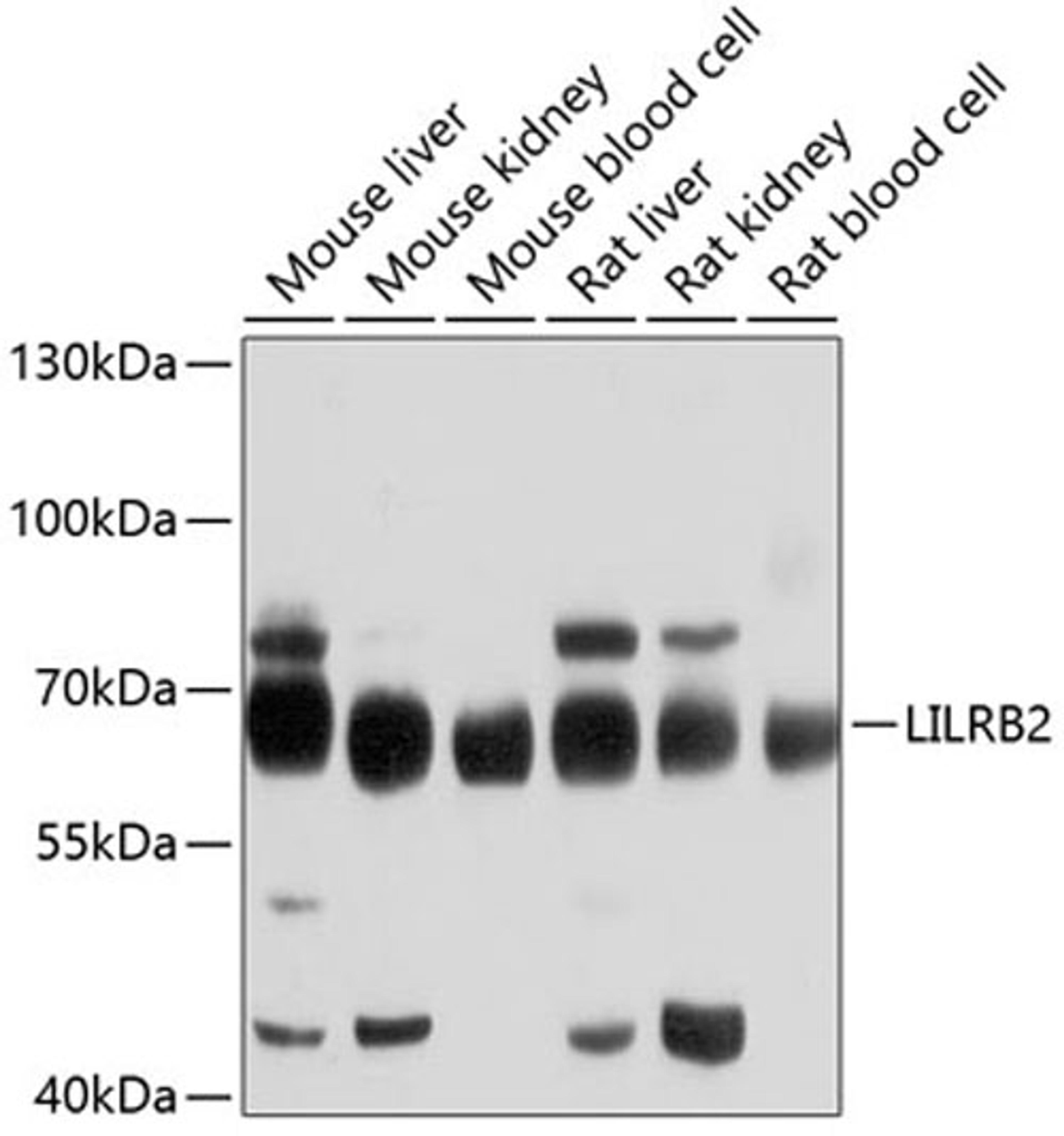 Western blot - LILRB2 antibody (A10135)