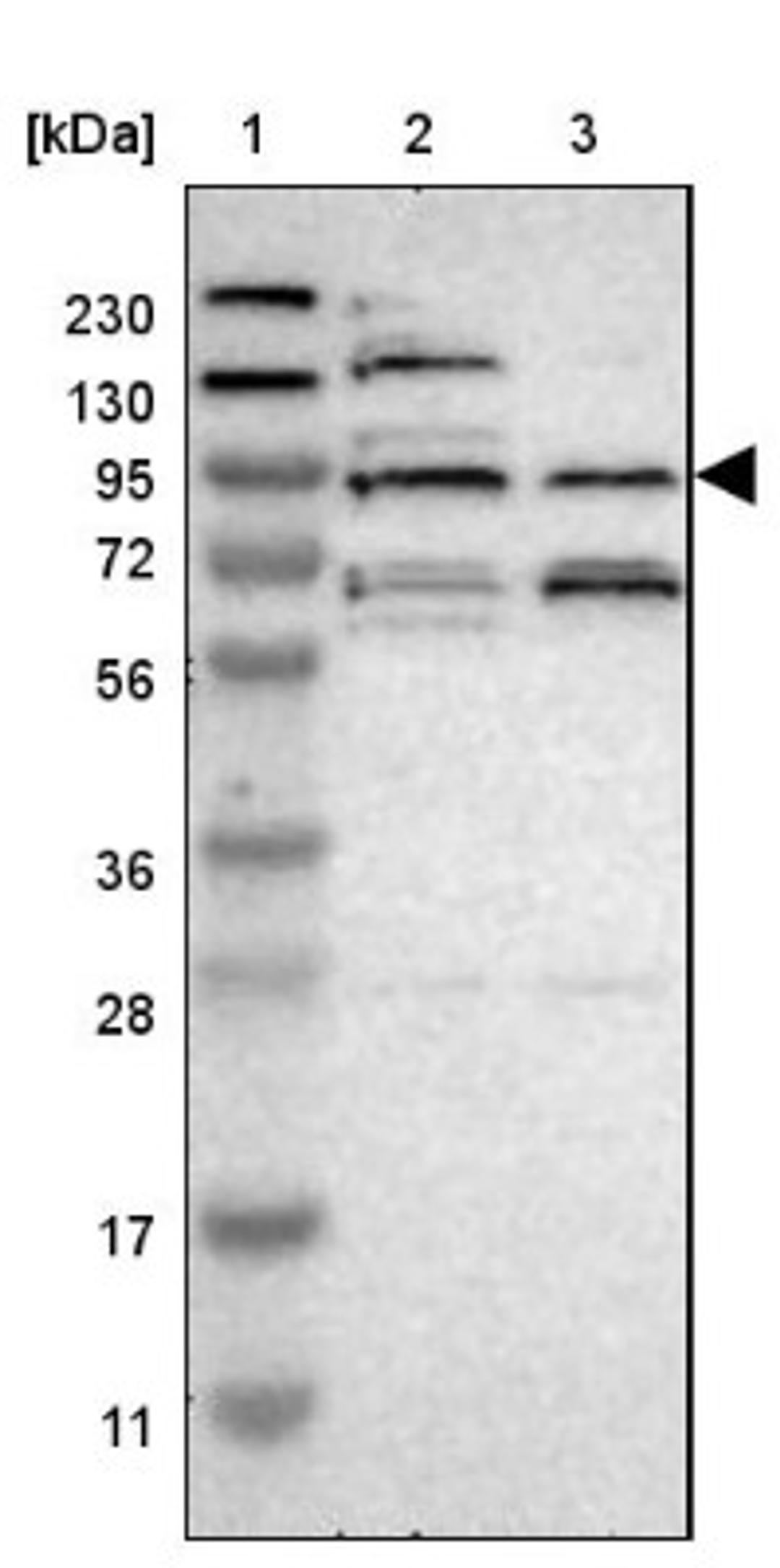 Western Blot: LRFN2 Antibody [NBP1-90459] - Lane 1: Marker [kDa] 230, 130, 95, 72, 56, 36, 28, 17, 11<br/>Lane 2: Human cell line RT-4<br/>Lane 3: Human cell line U-251MG sp