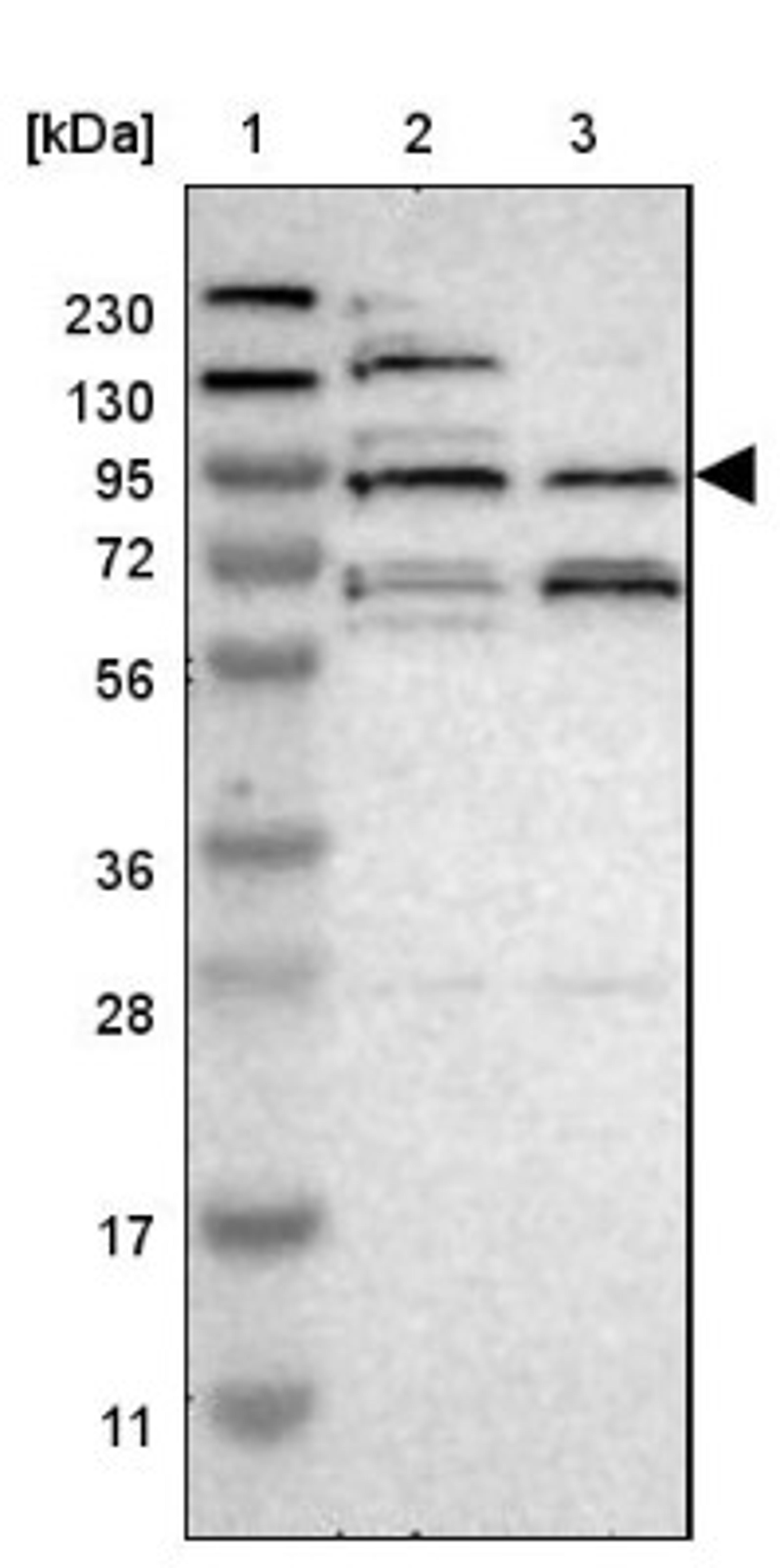 Western Blot: LRFN2 Antibody [NBP1-90459] - Lane 1: Marker [kDa] 230, 130, 95, 72, 56, 36, 28, 17, 11<br/>Lane 2: Human cell line RT-4<br/>Lane 3: Human cell line U-251MG sp