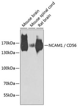 Western blot - NCAM1 / CD56 antibody (A7913)