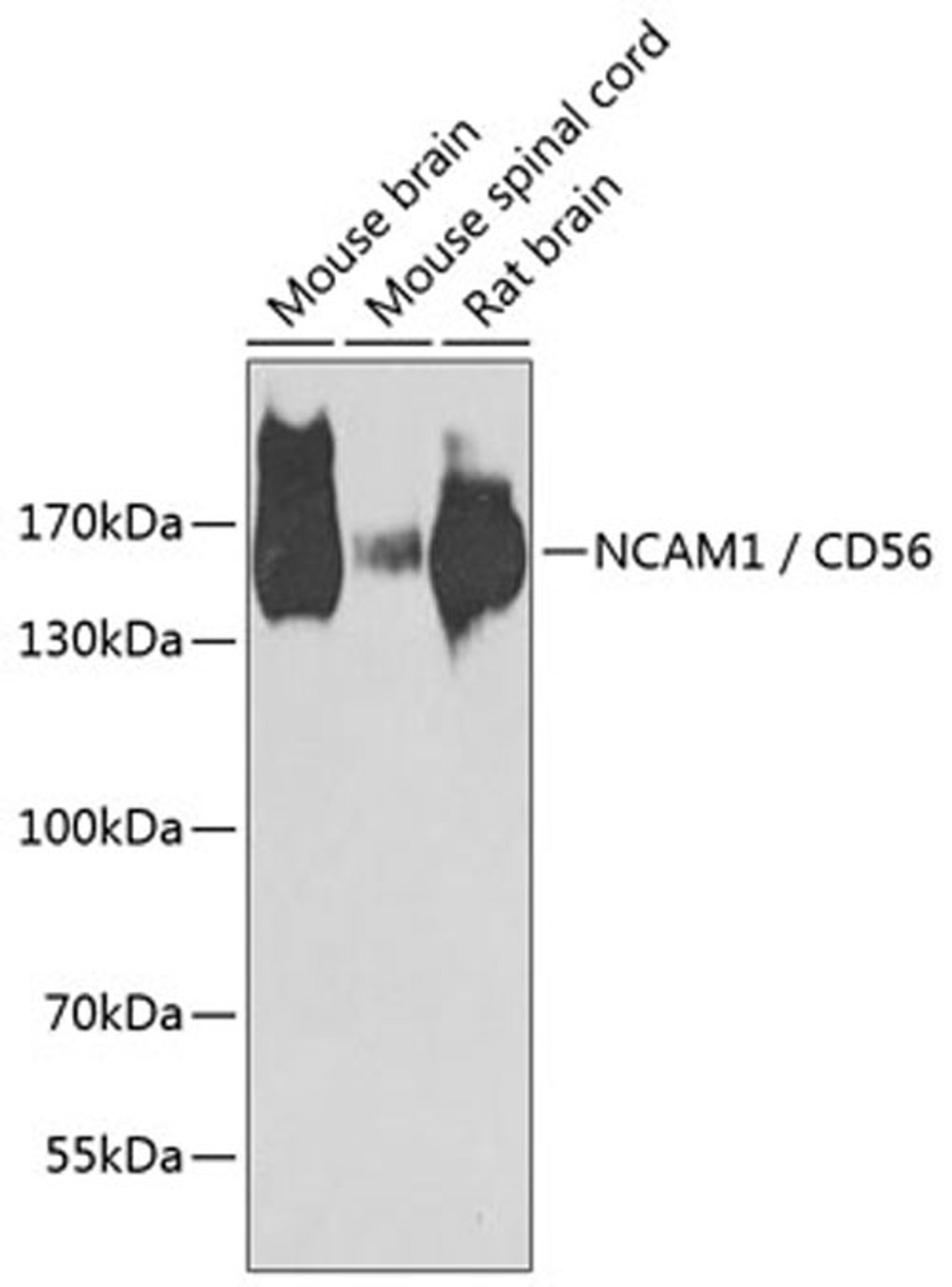 Western blot - NCAM1 / CD56 antibody (A7913)