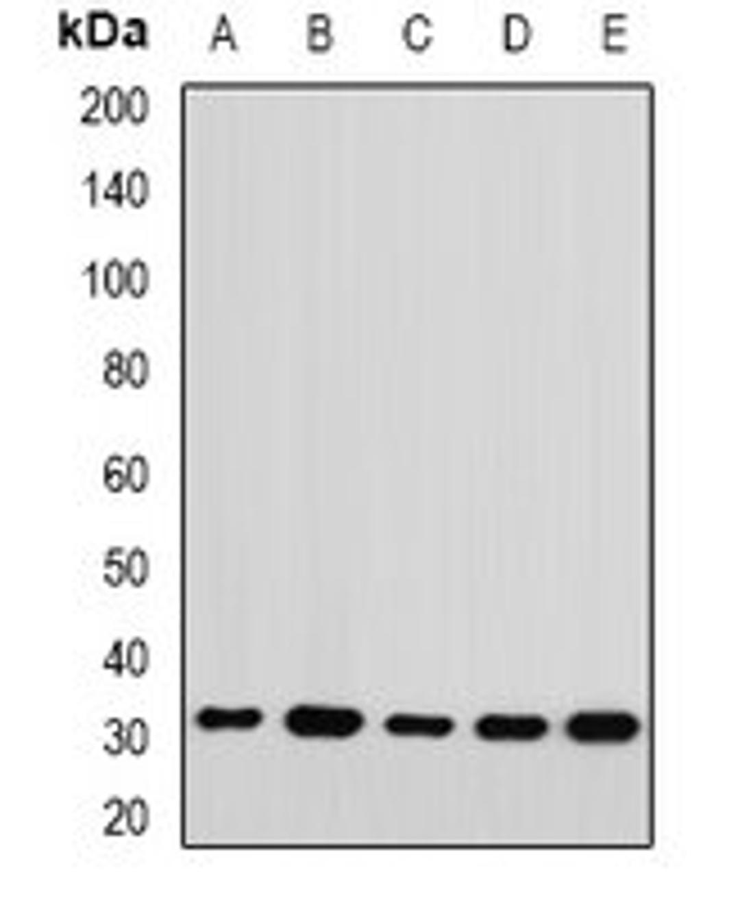 Western blot analysis of Jurkat (Lane1), HepG2 (Lane2), mouse spleen (Lane3), mouse ovary (Lane4), rat kidney (Lane5) whole cell lysates using RPL14 antibody