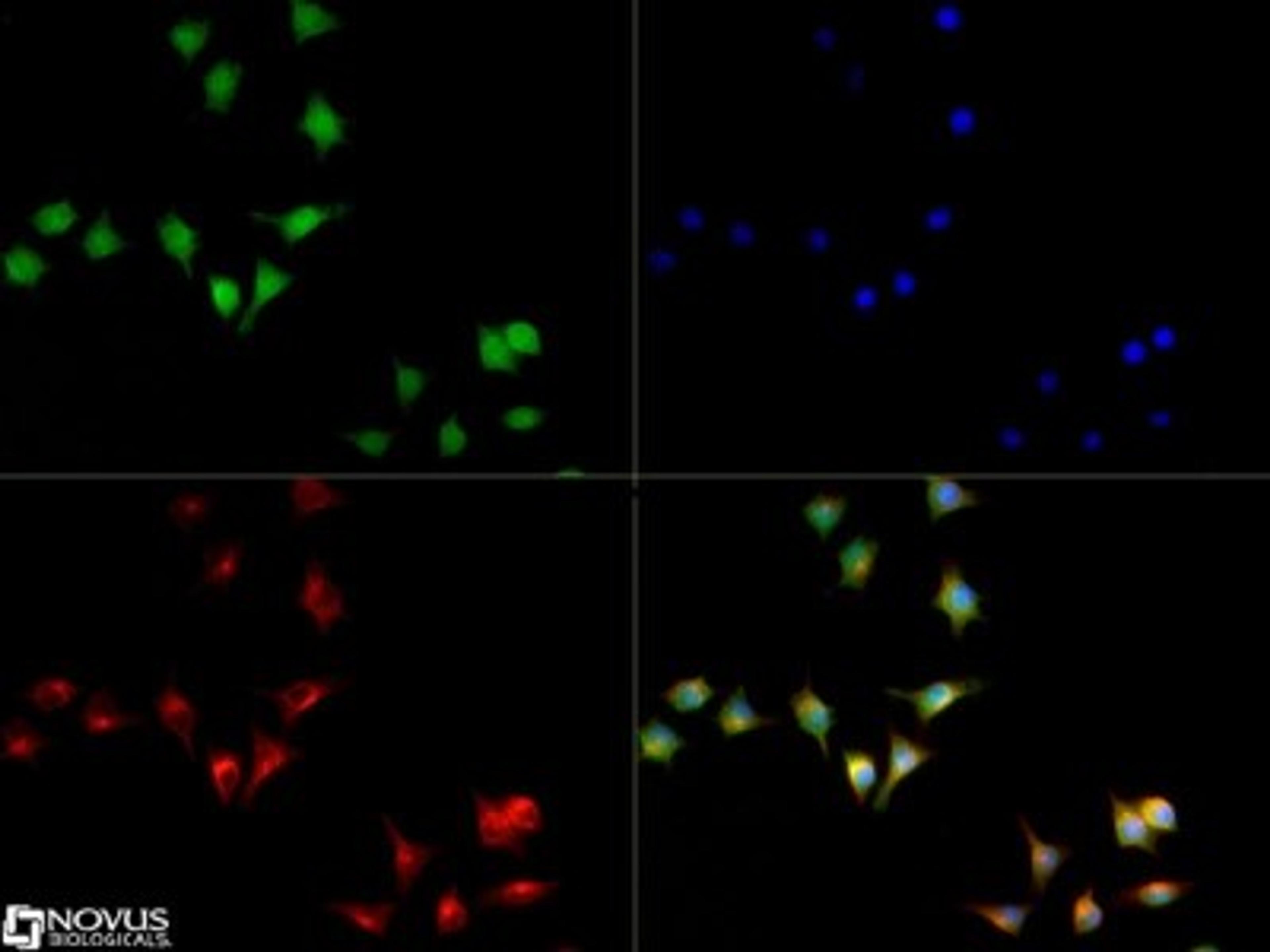 Immunocytochemistry/Immunofluorescence: Integrin alpha M/CD11b Antibody [NB110-89474] - CD11b antibody was tested in Raw264.7 cells with Dylight 488 (green). Nuclei and alpha-tubulin were counterstained with DAPI (blue) and Dylight 550 (red).