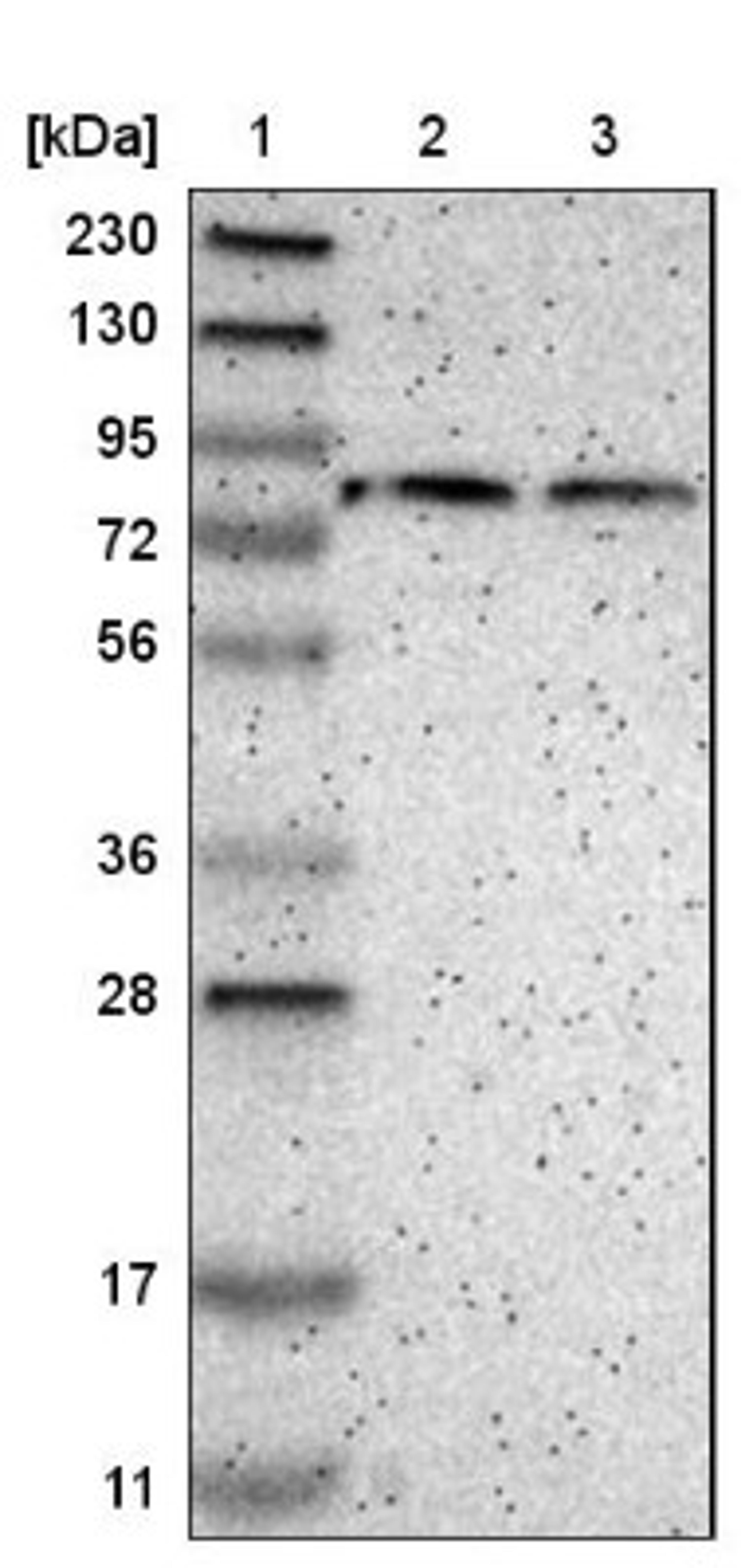 Western Blot: PASD1 Antibody [NBP1-84345] - Lane 1: Marker [kDa] 230, 130, 95, 72, 56, 36, 28, 17, 11<br/>Lane 2: Human cell line RT-4<br/>Lane 3: Human cell line U-251MG sp