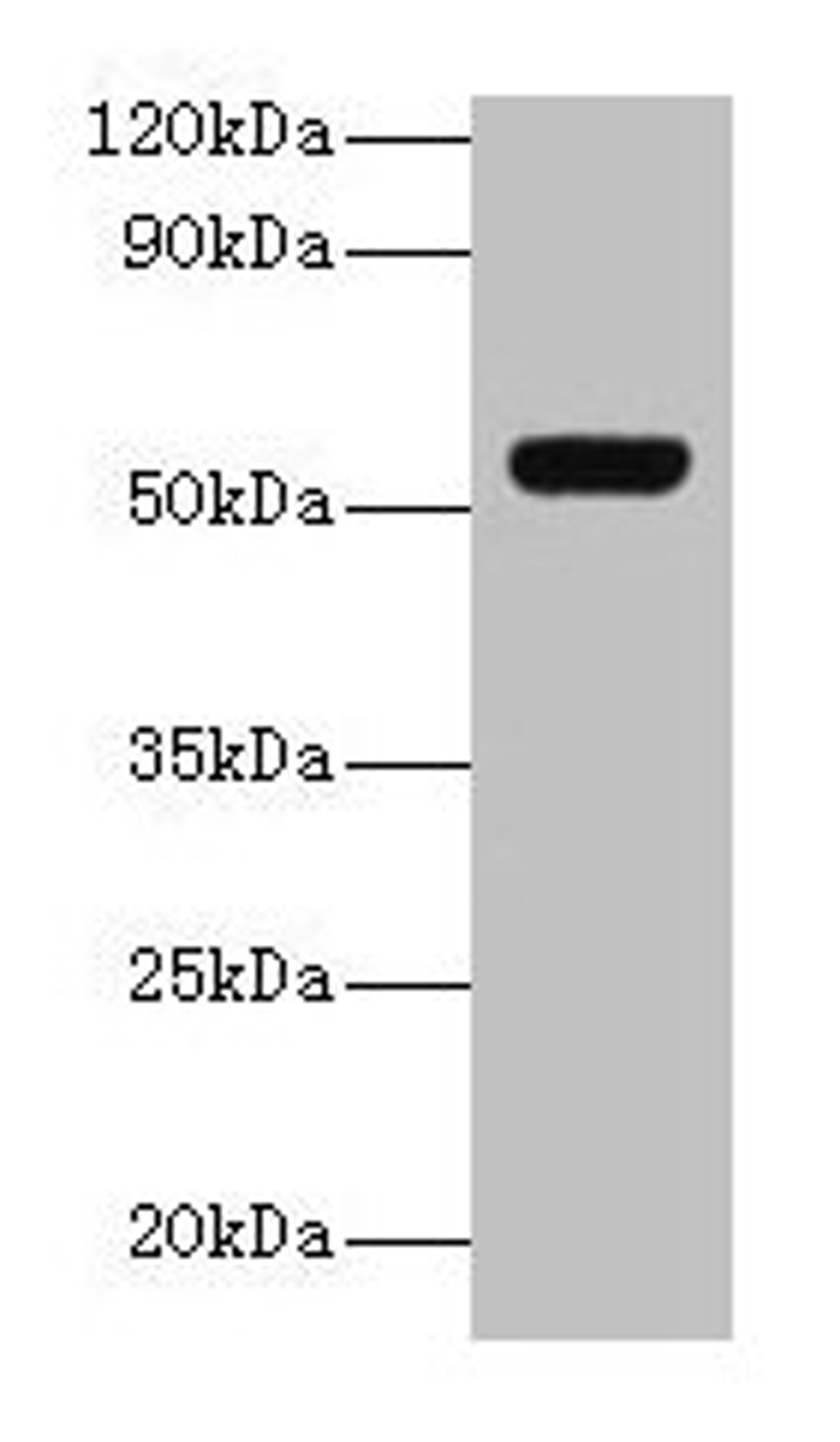 Western blot. All lanes: GC antibody at 2µg/ml + A549 whole cell lysate. Secondary. Goat polyclonal to rabbit IgG at 1/10000 dilution. Predicted band size: 53, 40, 56 kDa. Observed band size: 53 kDa