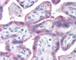 Immunohistochemistry staining of EGF receptor in placenta tissue using EGF receptor Antibody.