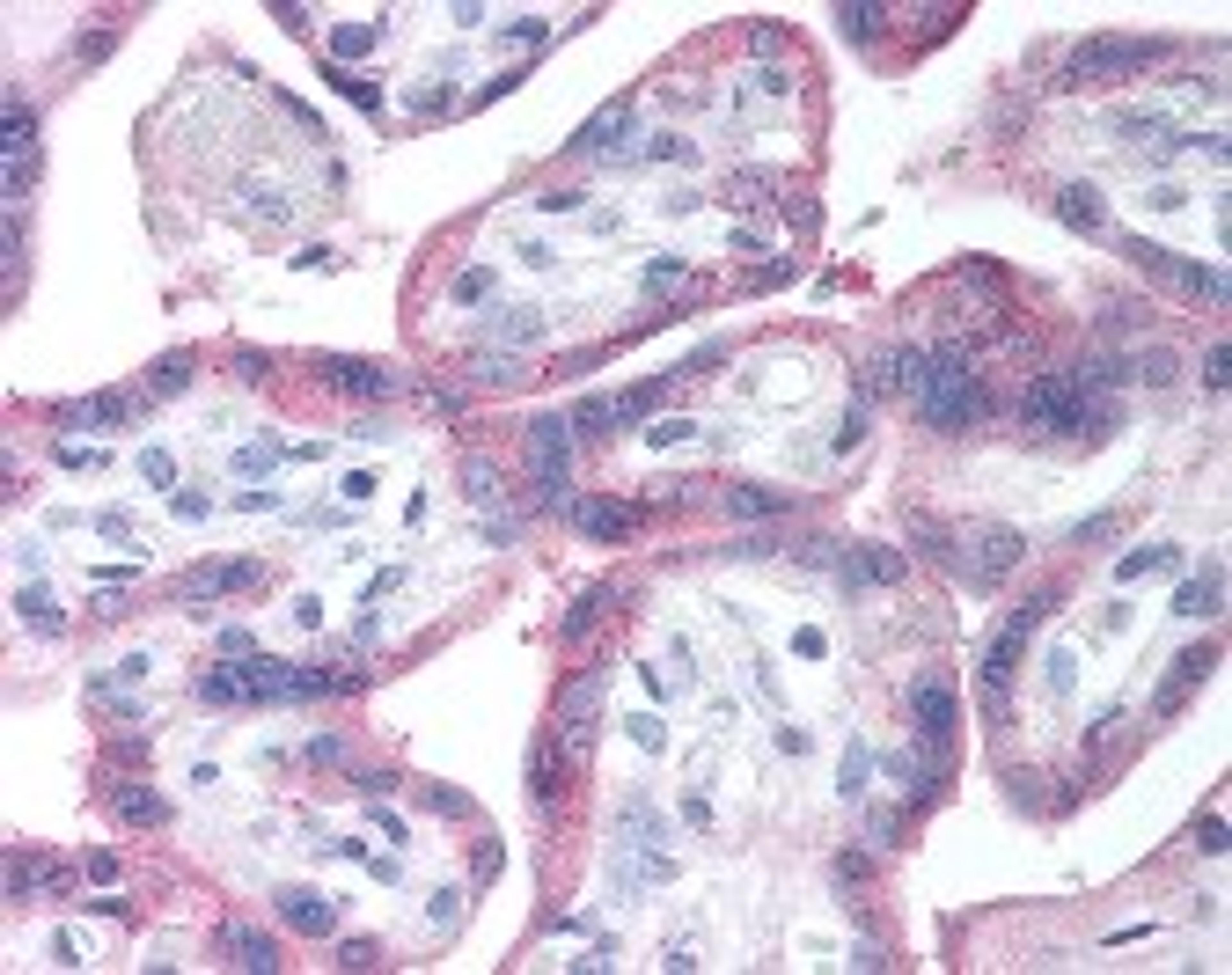 Immunohistochemistry staining of EGF receptor in placenta tissue using EGF receptor Antibody.