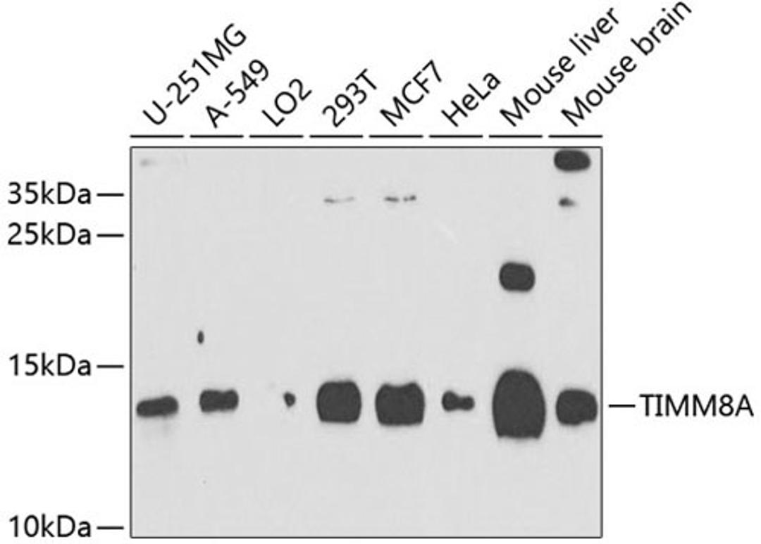 Western blot - TIMM8A antibody (A9811)