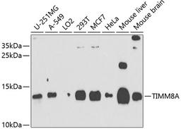 Western blot - TIMM8A antibody (A9811)