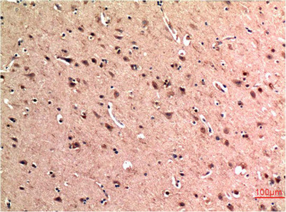 Immunohistochemical analysis of paraffin-embedded Human Brain Tissue using Beclin-1 Mouse mAb diluted at 1:200.